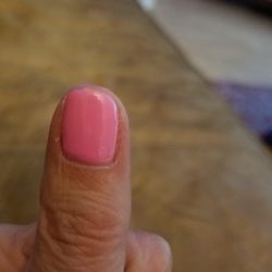 Kim's Nail - See how short my nail is and the cut along my cuticles. Ugh!