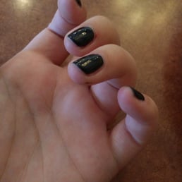 Sloppy application of product and damaged cuticle. Sloppy application of product and damaged cuticle.