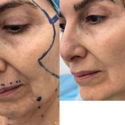 Sheis Beauty Medical Spa