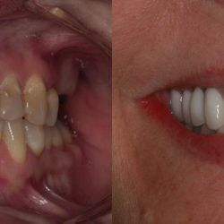 Southern Dental Implant Center - Before & After from Southern Dental Implant Center | Brentwood, TN