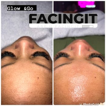 FacingIT - Skin Care Near Me - East Point, Georgia