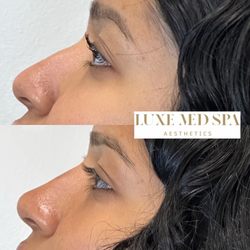 Luxe Med Spa Aesthetics