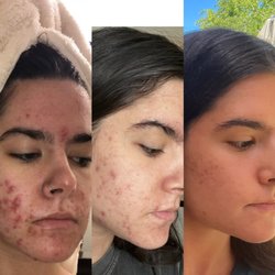 The Sacramento Esthetician