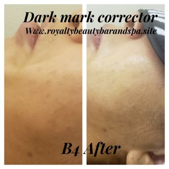 Royalty Beauty Bar - Dark mark corrector - Hair Extensions Near Me - Benbrook, Texas Royalty Beauty Bar - Dark mark corrector - Hair Extensions Near Me - Benbrook, Texas