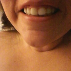 Thomas L Baba, DDS - Amazing...he created these in 97'(top only)...13 years of big smiles and lots of joy. Thanks Dr. B...u rock!
