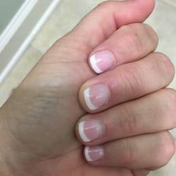 I asked for a full set of acrylic tips and for some reason I didn't get any! Acrylic overlay and weirdly shaped my natural nail. I asked for a full set of acrylic tips and for some reason I didn't get any! Acrylic overlay and weirdly shaped my natural nail.