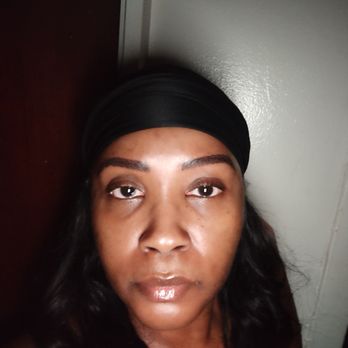Dmara Skinspa - Full face image after 4 hours. First day of a retouch session. - Skin Care Near Me - New York, New York Dmara Skinspa - Full face image after 4 hours. First day of a retouch session. - Skin Care Near Me - New York, New York