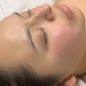 Aesthetic Glo - Post Facial - Eyelash Service Near Me - Granada Hills, California Aesthetic Glo - Post Facial - Eyelash Service Near Me - Granada Hills, California