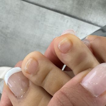 Club Nails - DAMAGED TOE NAILS - Nail Salons Near Me - Laguna Niguel, California