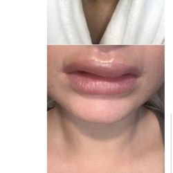 Veranda Salon & Spa - Photos of my horrendous lips and the last text sent before never again hearing a response.