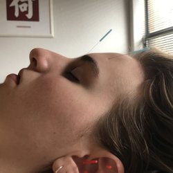 Linda Judd Acupuncture and Chinese Herbal Medicine