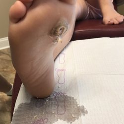 InStride Queen City Foot and Ankle Specialists