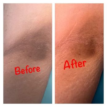 Soft Skin By Miguel - Luxury Under Arm lightning wax - Estheticians Near Me - Fresno, California Soft Skin By Miguel - Luxury Under Arm lightning wax - Estheticians Near Me - Fresno, California