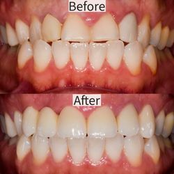 A New Smile