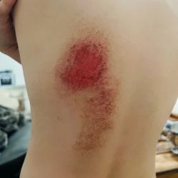 Coach Patty's Gymnastics - What happened to my son.