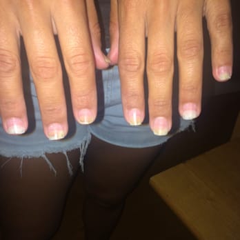 Hollywood Nails NY - Hollywood Nails caused my nails to have fungus!! - Nail Salons Near Me - New York, New York Hollywood Nails NY - Hollywood Nails caused my nails to have fungus!! - Nail Salons Near Me - New York, New York