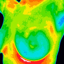 The Thermography Center