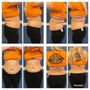 Photo of Lipo Laser