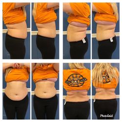 Lipo Laser - Results! 2/14 inches lost first time!