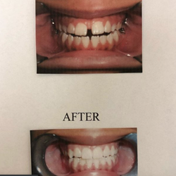McQueen Orthodontic Specialists - Before & After