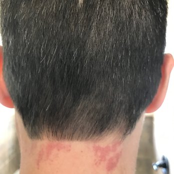 Studio 209- El Paso - My hair cut and neck injury after my haircut at Studio 209 10/29 - Hair Salons Near Me - El Paso, Texas Studio 209- El Paso - My hair cut and neck injury after my haircut at Studio 209 10/29 - Hair Salons Near Me - El Paso, Texas