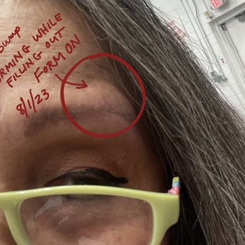 Costco Wholesale 360 - Bump forming while I was filling out complaint form on Aug. 1, 2023 - Wholesale Stores Near Me - Fredericksburg, Virginia Costco Wholesale 360 - Bump forming while I was filling out complaint form on Aug. 1, 2023 - Wholesale Stores Near Me - Fredericksburg, Virginia