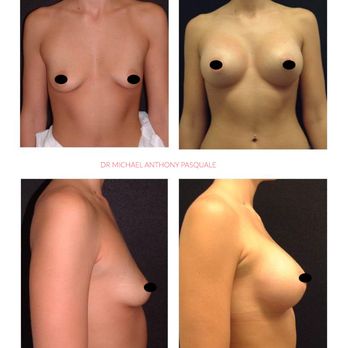 Michael Pasquale, DO - Breast Implants Hawaii - Cosmetic Surgeons Near Me - Honolulu, Hawaii Michael Pasquale, DO - Breast Implants Hawaii - Cosmetic Surgeons Near Me - Honolulu, Hawaii