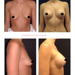 Michael Pasquale, DO - Breast Implants Hawaii