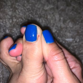 Jade Nails & Spa - Both toes were cut and both were bleeding. - Nail Salons Near Me - Miami, Florida Jade Nails & Spa - Both toes were cut and both were bleeding. - Nail Salons Near Me - Miami, Florida