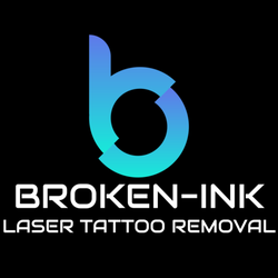 Broken-ink Laser Tattoo Removal