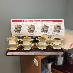 Integrative Chiropractic and Weight Loss - Lumbar examples