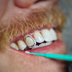 Groovy Glow Teeth Whitening