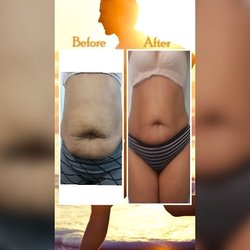 Bella SPA Skin Care & Weight Loss