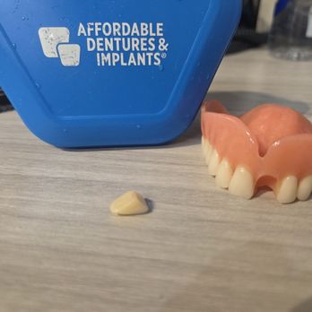 Affordable Dentures & Implants - Third time 5.4.26 - Prosthodontists Near Me - Lynnwood, Washington Affordable Dentures & Implants - Third time 5.4.26 - Prosthodontists Near Me - Lynnwood, Washington