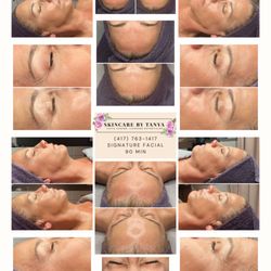 Skincare By Tanya - 90-min Signature Facial featuring dermaplaning, plasma, peptides & Korean tech for smooth, glowing, rejuvenated skin. 