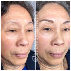 Brow Symmetry - Microblading can instantly brighten up your face, shave off a few years and give you a more polished look.