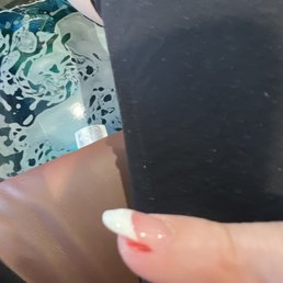 Bleeding finger nail, didn't get a picture of my bleeding toe Bleeding finger nail, didn't get a picture of my bleeding toe
