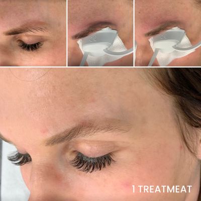 Microblading Gone Wrong? Let's Fix that! - 10% Off for all new clients! Woman Owned & Operated. Certified Licensed Esthetician. Multiple methods for your comfort in tattoo removal! Microblading Gone Wrong? Let's Fix that! - 10% Off for all new clients! Woman Owned & Operated. Certified Licensed Esthetician. Multiple methods for your comfort in tattoo removal!