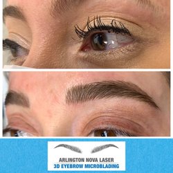 Arlington NOVA Laser & 3D Microblading