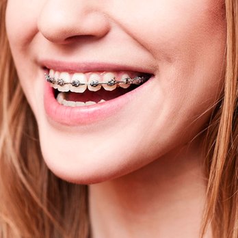 Oswego Dental - General Dentistry Near Me - Oswego, Illinois Oswego Dental - General Dentistry Near Me - Oswego, Illinois