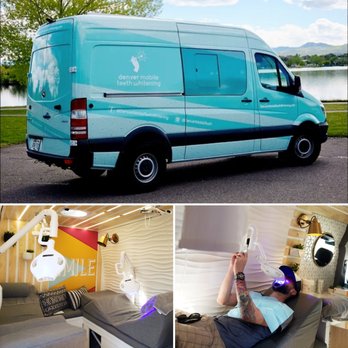 Glintr Mobile Teeth Whitening - Awesome set-up! - Teeth Whitening Near Me Glintr Mobile Teeth Whitening - Awesome set-up! - Teeth Whitening Near Me