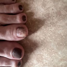 The polish on her toe slid right off.