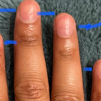 Lavender Nail Salon - Deep grooves left in the nail when they insisted on using the automatic tool to scrub off my gels. - Nail Salons Near Me - Sacramento, California