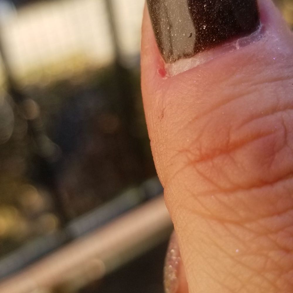 Nail Art Studio - After I pushed back my cuticles, I have this much gap and it has been only 3 days. It looks like I have a 2 weeks worth of nail growth. - Nail Salons Near Me - Northbrook, Illinois Nail Art Studio - After I pushed back my cuticles, I have this much gap and it has been only 3 days. It looks like I have a 2 weeks worth of nail growth. - Nail Salons Near Me - Northbrook, Illinois