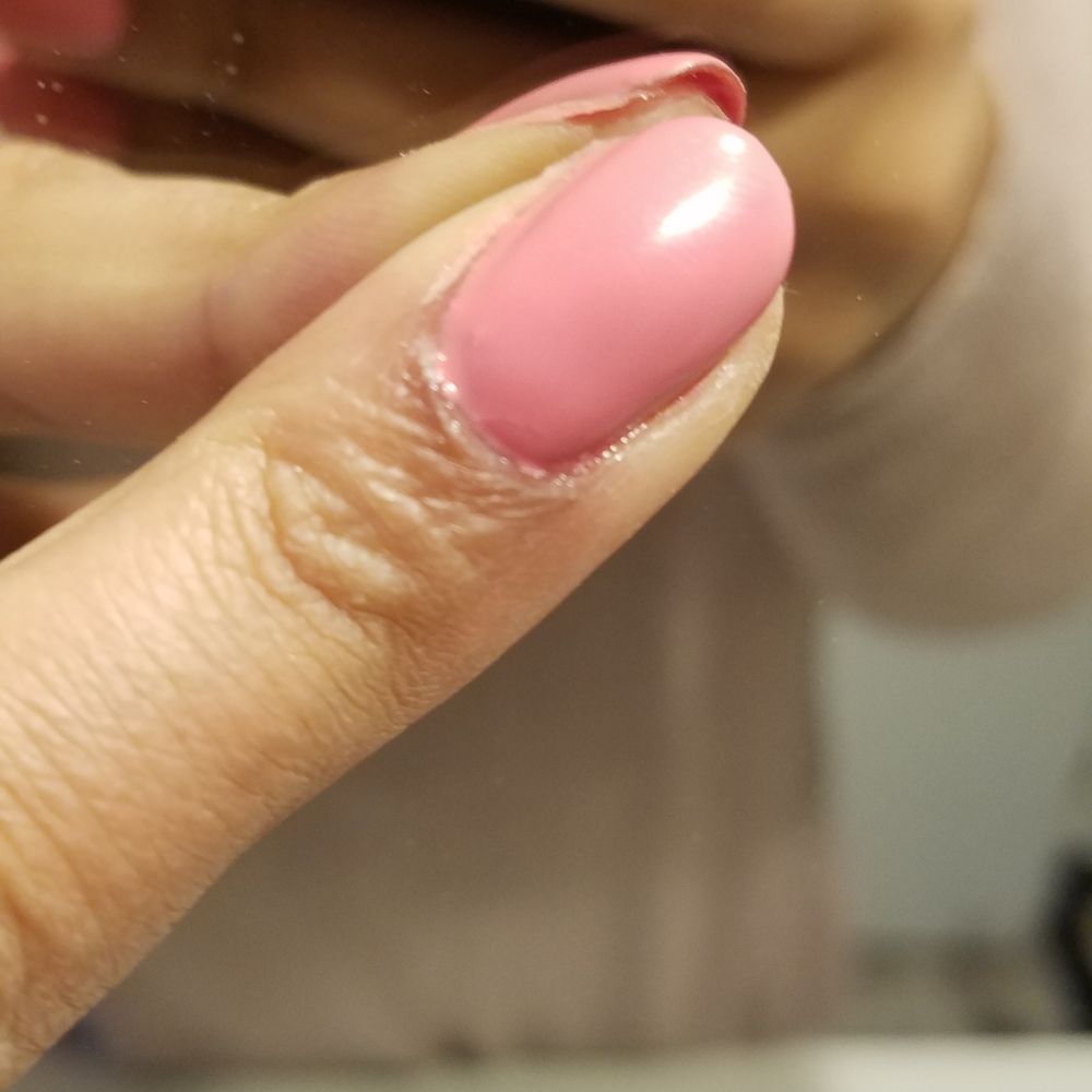 Lovely Nails - Nail polish (Shellac) stuck on skin/not on nail - Nail Salons Near Me - Bothell, Washington Lovely Nails - Nail polish (Shellac) stuck on skin/not on nail - Nail Salons Near Me - Bothell, Washington