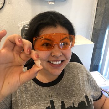 Joy Dental - My wisdom tooth and I - Cosmetic Dentists Near Me - Tijuana, BCN