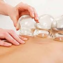New Orleans Acupuncture