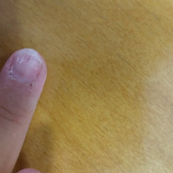 Sessy Nails - My nail after the sns nail and the fake nail came off. My nail was super thin and damaged :-( - Nail Salons Near Me - Placentia, California