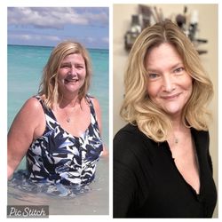 Renew Bariatrics - Before and after my gastric Sleeve. This was four years apart.
