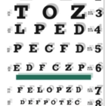 TLC Laser Eye Centers - Ghosting example #1 (What I see even with glasses intermittently) - Optometrists Near Me - Westchester, Illinois